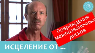 Ты исцелён! Это – невероятно! - Исцеление после выпадения межпозвоночных дисков