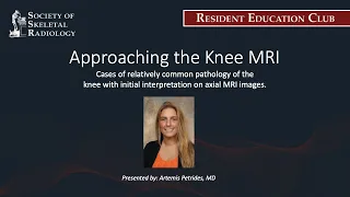 SSR Resident Education Club - Approaching the Knee MRI - Sep 15, 2021