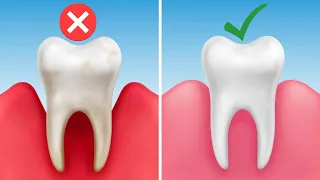 Zahnfleischbluten - In nur 7 Tagen Zahnfleischentzündung los werden