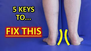 The 5 KEYS To Improve Flat Feet (Fallen Arches) & Foot Overpronation