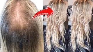 5 LIFE CHANGING HACKS FOR THIN & FINE HAIR! *must watch!