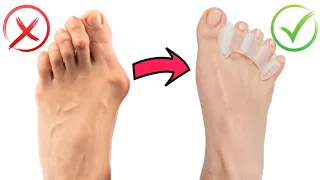 Build Healthy Feet - BEST TOE SPACERS