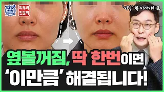 옆볼꺼짐, 땅콩형얼굴이 고민이라면? 😱 (Feat. 볼꺼짐 유형별, 원인별 꿀팁)