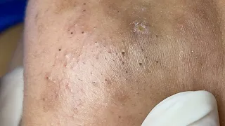 Satisfying Relaxing with Sac Dep Spa Video (#203)