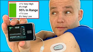 Tandem tslim x2 & Control IQ Changed My Life | Insulin Pump Agorithm Review