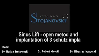 Sinus Lift open method and implantation of 3 IMPLA implants from MANI SCHÜTZ