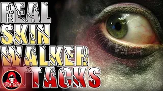 5 REAL Skinwalker Attacks (Part 2)