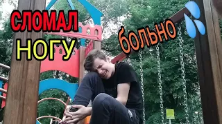 ПРАНК - НАД МОЕЙ СЕСТРОЙ!!! СЛОМАЛ НОГУ ? 😱