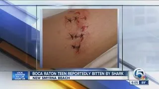 Boca Raton teen reportedly bitten by shark