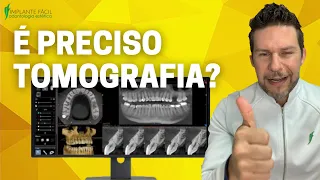 É PRECISO FAZER TOMOGRAFIA?