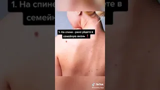 Что означает родинка на твоём теле