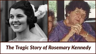 Rosemary Kennedy: The Tragic Legacy of Lobotomy