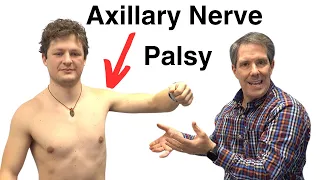 Signs of Axillary Nerve Palsy
