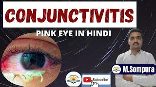 Conjunctivitis  pink eye (MSN) in hindi |   cause, symptoms treatment | red eye | pink eye treatment