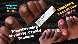 Toe-tally Transformed | At-Home Pedicure Transformation with btartboxnails XCOATTIPS Toe Nail Tips