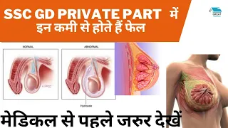 ssc gd private part में इन कमियों की वजह से होते हैं फेल । ssc gd medical