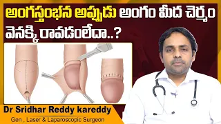 అంగం మీద చెర్మం || Common penile problems In Telugu || Dr Sridhar Reddy || Treatment Range Hospitals