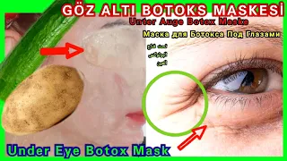 ბუნებრივი ქვეშ თვალის Botox-Do 1 კვირა სახლში, მოშორება ნაოჭების და სისხლჩაქცევები # ბუნებრივი botox