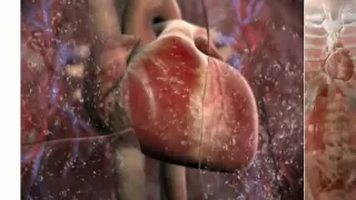 3D Medical Animation Congestive Heart Failure Animation