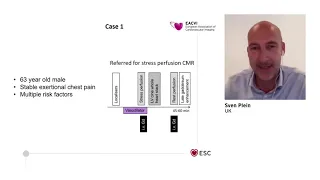 EACVI free webinar: Absolute quantification of myocardial perfusion