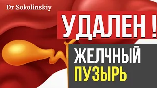 Удален ЖЕЛЧНЫЙ пузырь! Какие проблемы с ЖКТ после удаления желчных камней? Как их предотвратить?