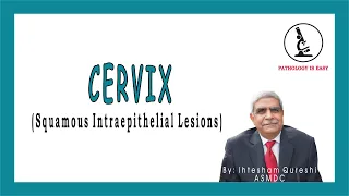 Cervix (Squamous Intraepithelial Lesions) | Female Genital System