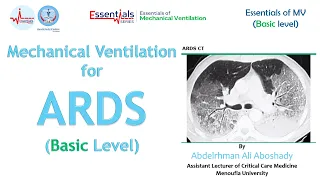 Lecture 14 - Mechanical Ventilation for ARDS (Basic Level)  -  Basic Mechanical Ventilation Course