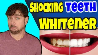 Get The WHITEST TEETH EVER In 7 Days With This NEW Kit! | Chris Gibson
