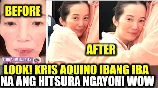 LOOK! Kris Aquino BUMALIK na ang DATING GLOW at GANDA! Alamin ang latest sa kanyang HEALTH!