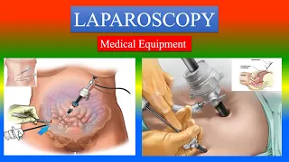 LAPAROSCOPY - Definition , parts, uses , How to use ? - Medical Equipment