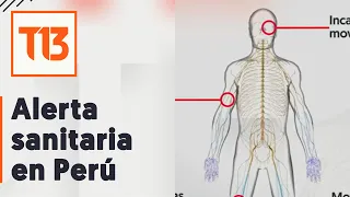 Alerta sanitaria en Perú por síndrome de Guillain-Barré