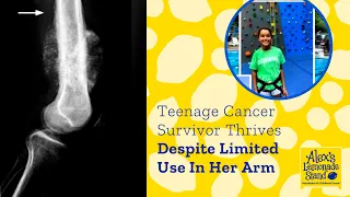 Nina, a Resilient Teanage Cancer Survivor Thrives Despite Limited Use Of Her Arm