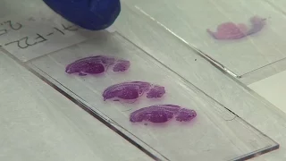 San Diego Lab Creates Partially Human Pig Embryos