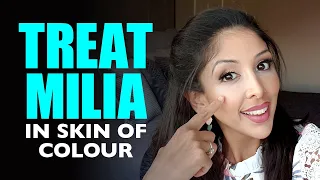 Milia Treatment for Brown/ Dark skin of colour | Myths, Mistakes, Professional treatment | DR V