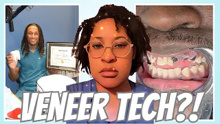 TikTok Veneer Tech Are Ruining Peoples Teeth