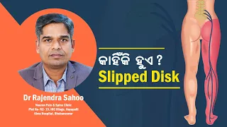 Is It Your Back Pain Or Any Serious Nerve Issue? Dr Rajendra Sahoo | Sciatica | Kanak News