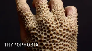 DON'T WATCH THIS! 🤮🤮 (Trypophobia Test) #shorts #viral #tiktok