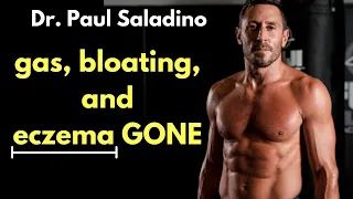 Dr. Paul Saladino Interview: Carnivore diet, Healing Eczema, What to eat