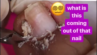 What is this coming out of that nail