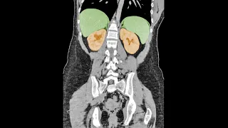 A Student Felt A Sharp Pain In Her Side. This Is How Her Organs Shut Down.