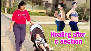 Healing process after c section | HINDI | WITH ENGLISH SUBTITLES | Debina Decodes |