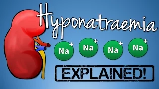 Hyponatremia EXPLAINED with Animation