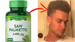 Saw Palmetto for Hair Loss!? (Ft. Steve Cook)