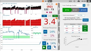 How to give a guided fluid challenge | LiDCO (US)