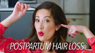Postpartum Hair Loss & Regrowth: My Tips & Must-Haves! | Susan Yara