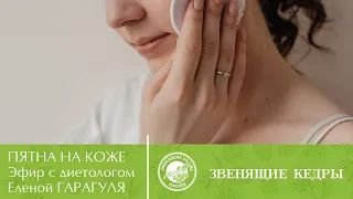 Пятна на коже | Прямой эфир с диетологом Еленой Гарагуля