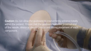 PleurX® pleural catheter placement video