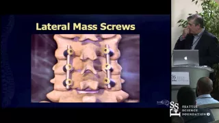 C1, C2 Anatomy & Subaxial Cervical Spine Reconstruction by Nicholas Theodore, M.D.