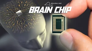 THE BRAIN CHIP By Neuralink ! Future Is Now