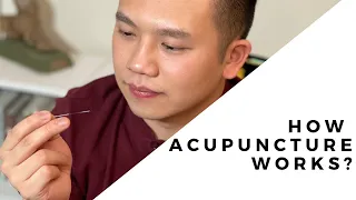 What is Acupuncture? And does it Work?